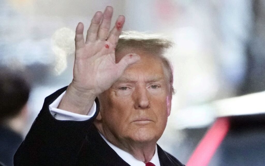 На руці Трампа з'явилися загадкові червоні плями